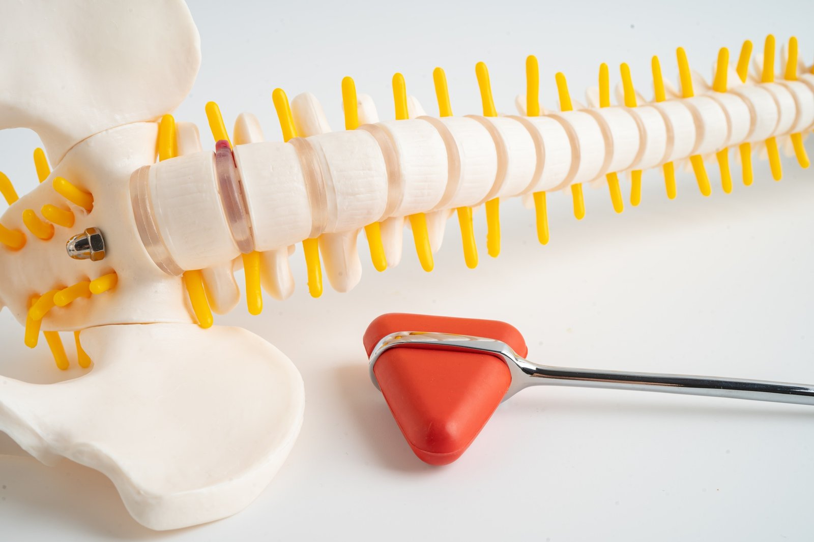 Human spinal nerve and bone with percussion reflex hammer, model for treatment medical